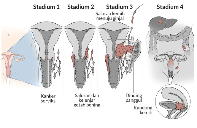 Ilustrasi (Foto: Alodokter)